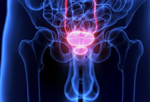 سرطان پروستات