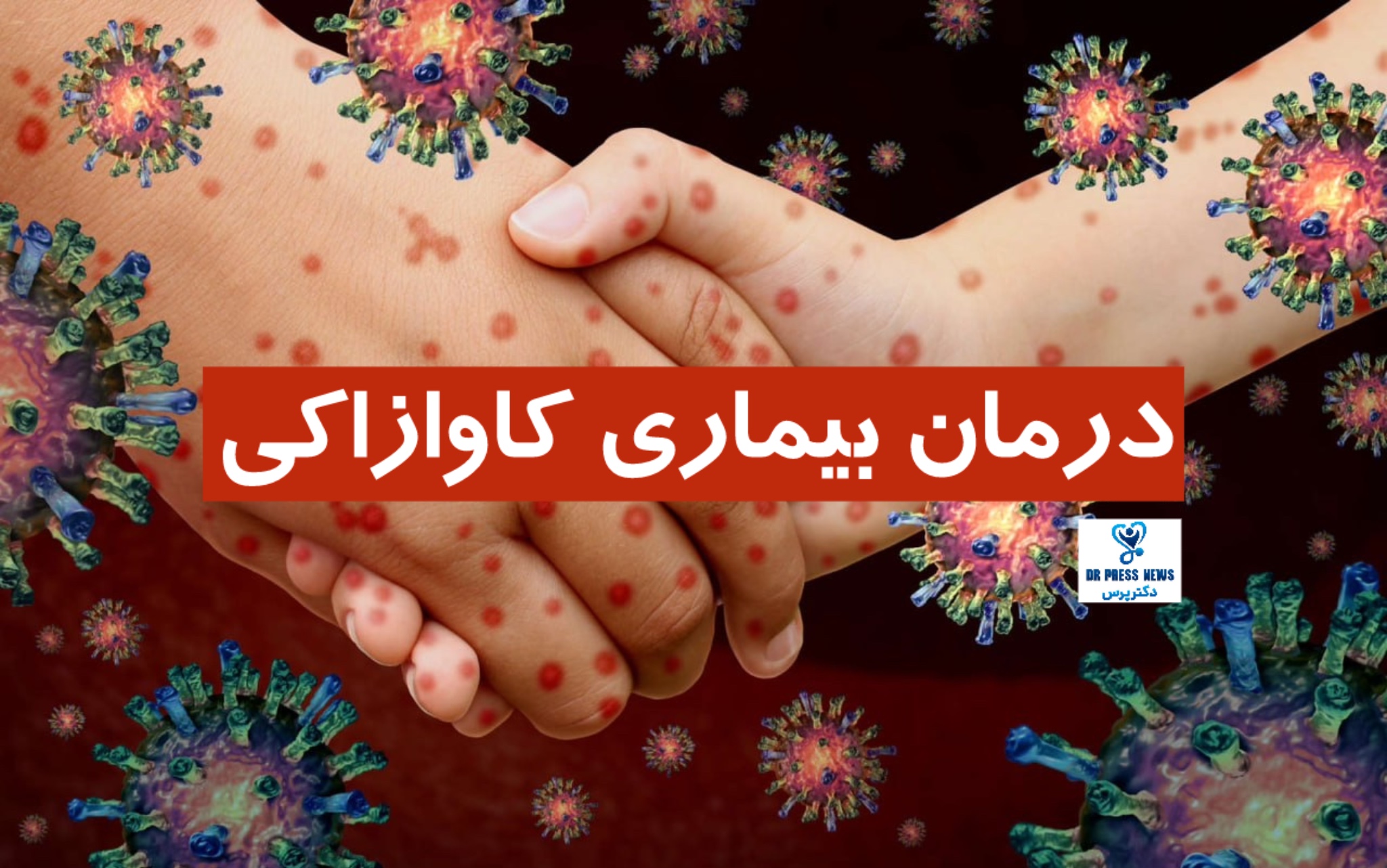 بیماری کاوازاکی: والدین چقدر باید نگران باشند؟