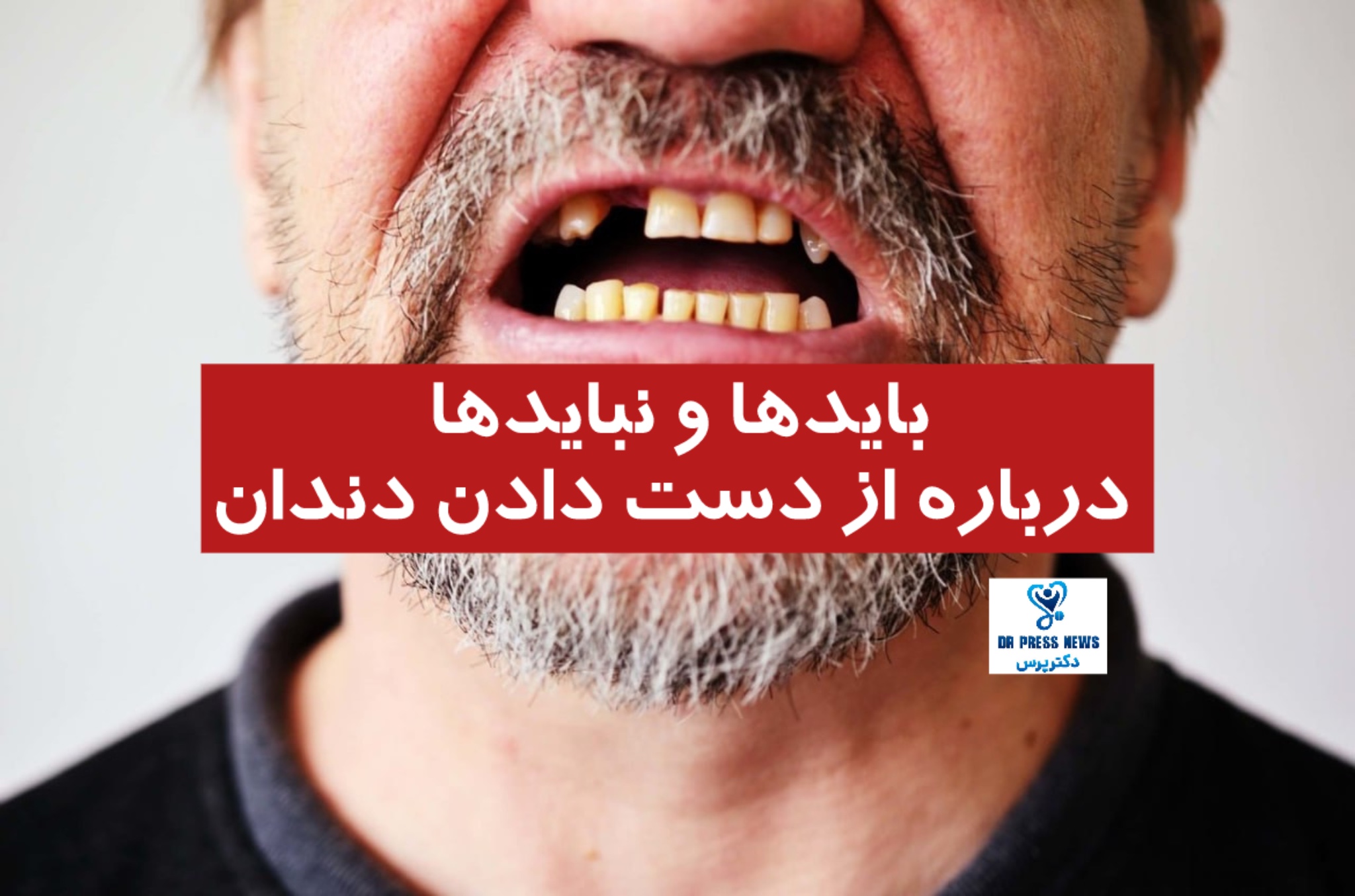 از دست دادن دندان‌ها