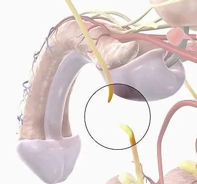  تجربه واقعی کاربران از وازکتومی