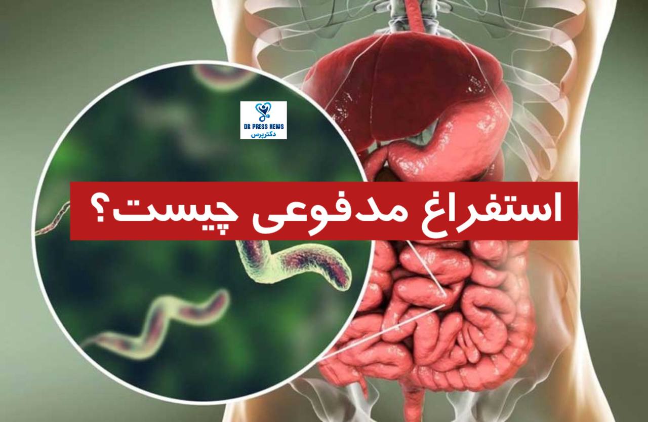 استفراغ مدفوعی