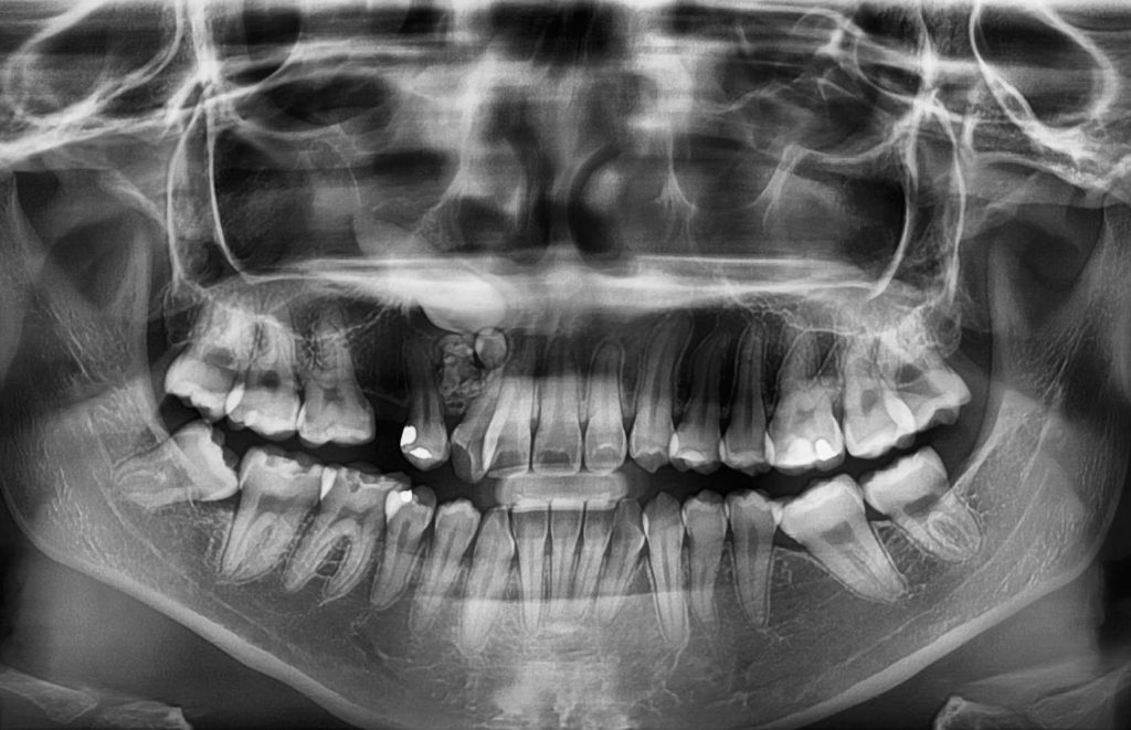 بیماری‌ دهان