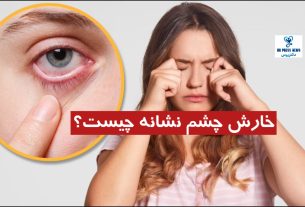 خارش چشم نشانه چیست