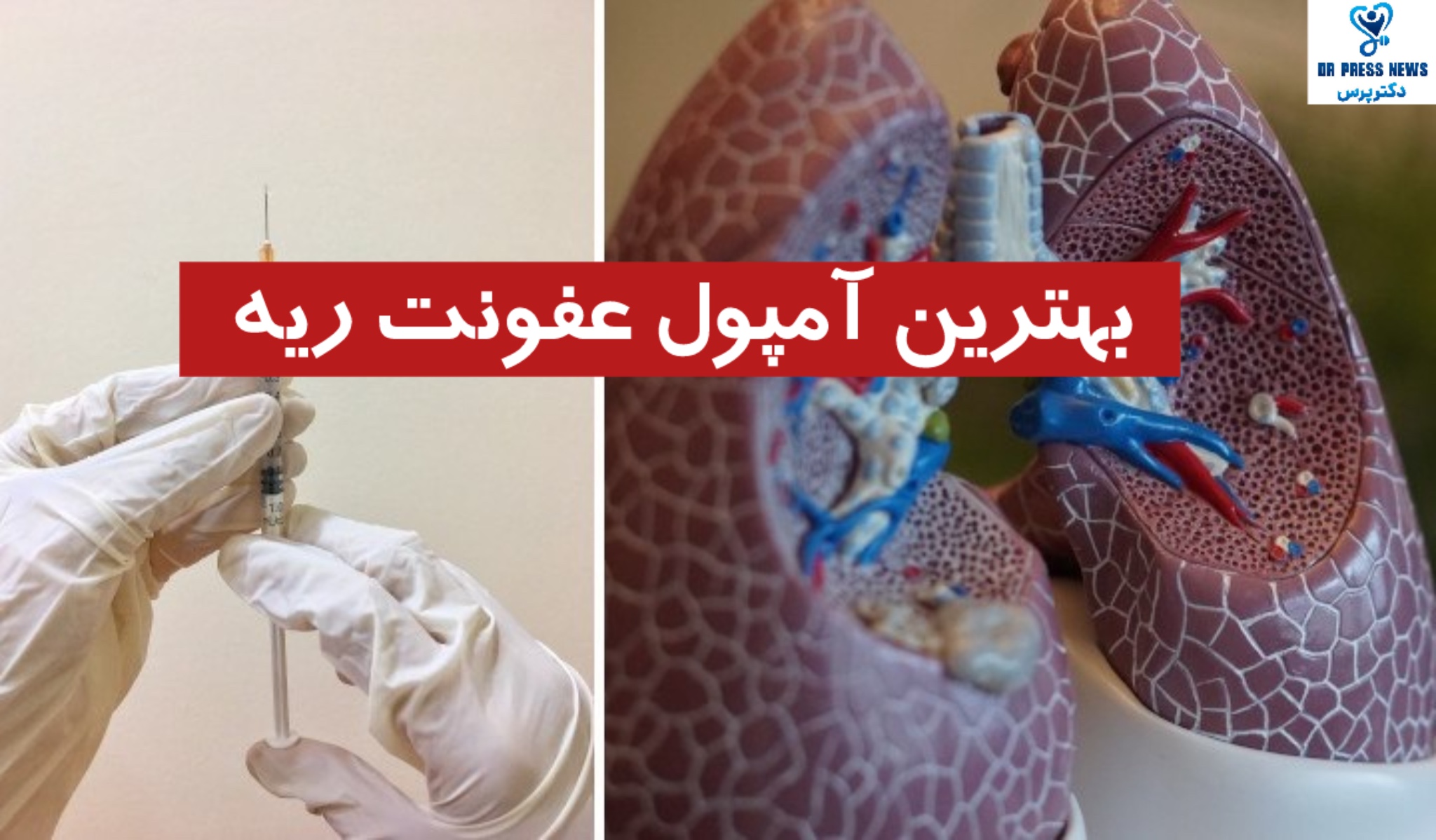 بهترین آمپول عفونت ریه + انواع و کاربردها