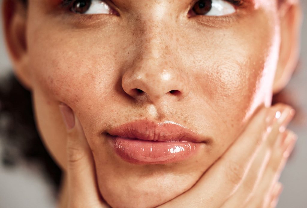 7 علت پوست چرب + راه جلوگیری از چرب شدن پوست