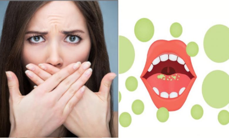 مراحل درمان بوی بد دهان در کلینیک تخصصی