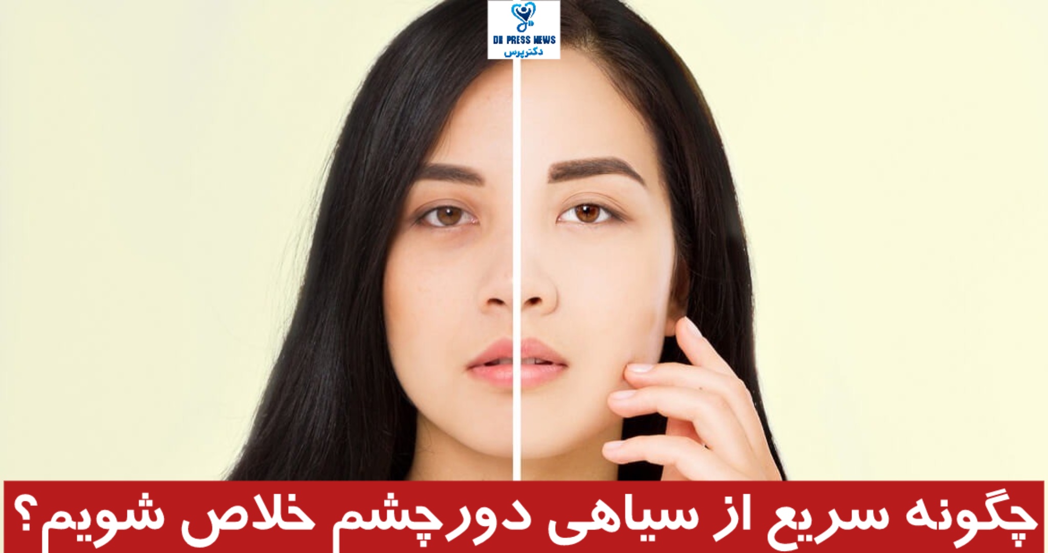 چگونه سریع از شر سیاهی دور چشم خلاص شویم: 5 نکته آسان