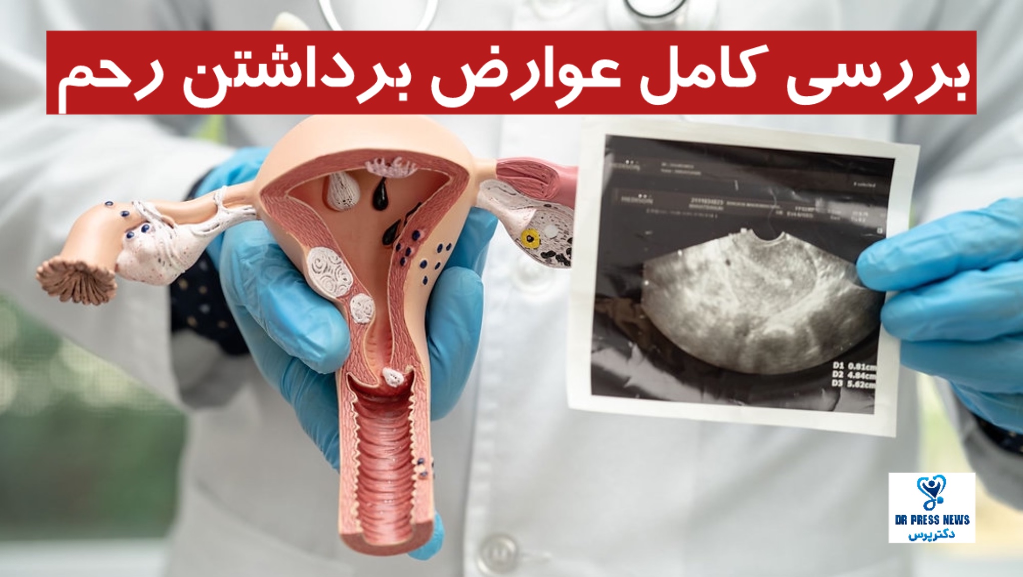 بررسی کامل عوارض برداشتن رحم + انواع عوارض و راه‌های درمان