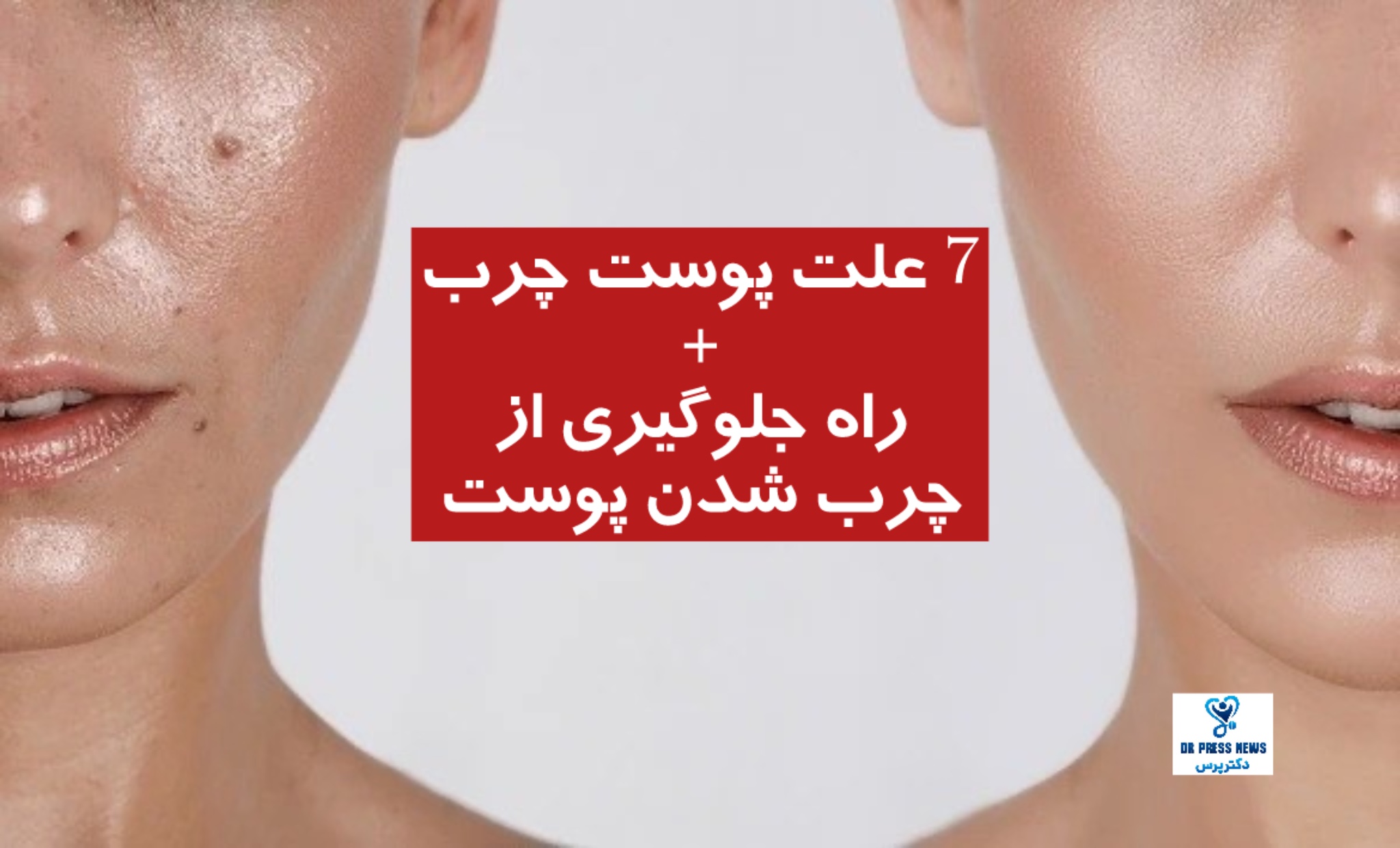 7 علت پوست چرب + راه جلوگیری از چرب شدن پوست