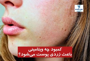 کمبود چه ویتامینی باعث زردی پوست می‌شود؟