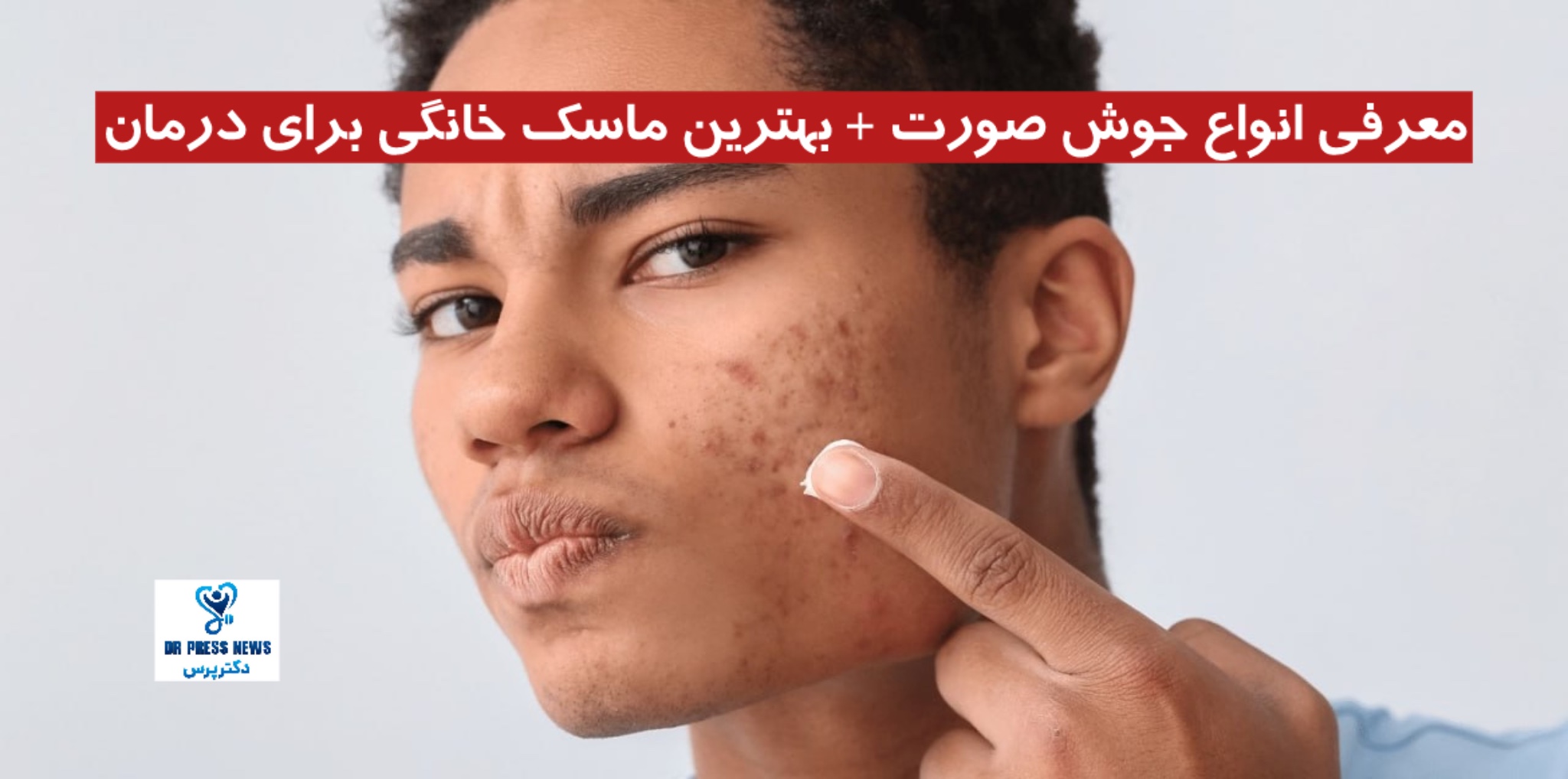 انواع جوش‌ صورت + بهترین ماسک‌ خانگی برای درمان