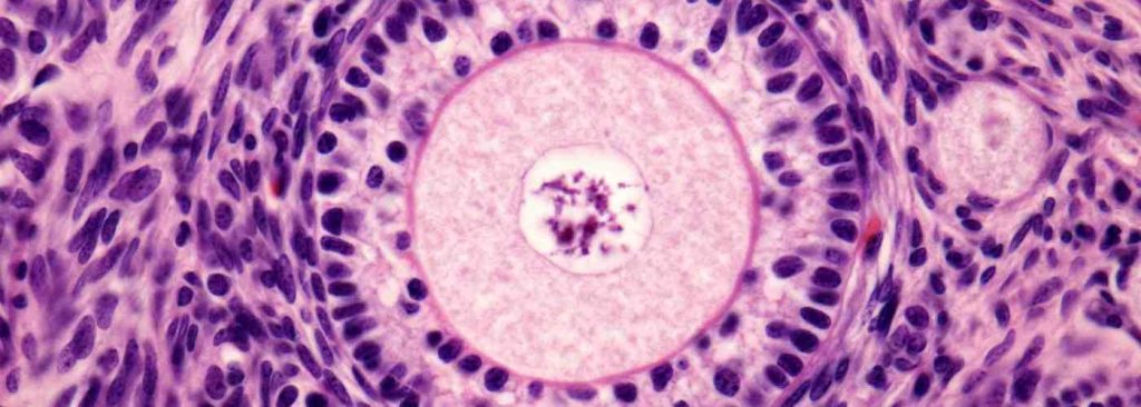 تاثیر سن بر تعداد فولیکول‌ها