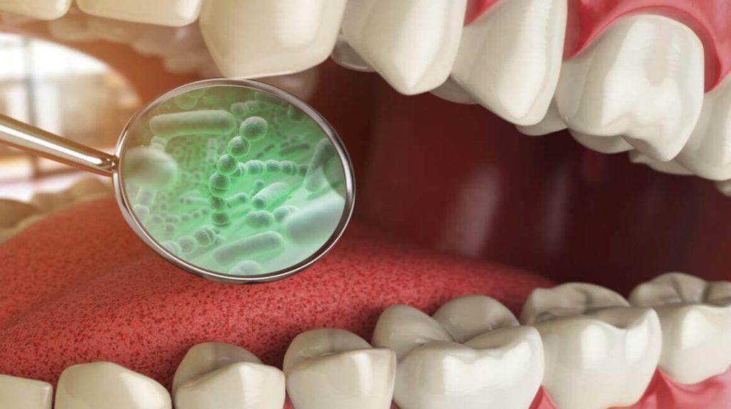 بوی بد دهان (هالیتوزیس) چیست؟