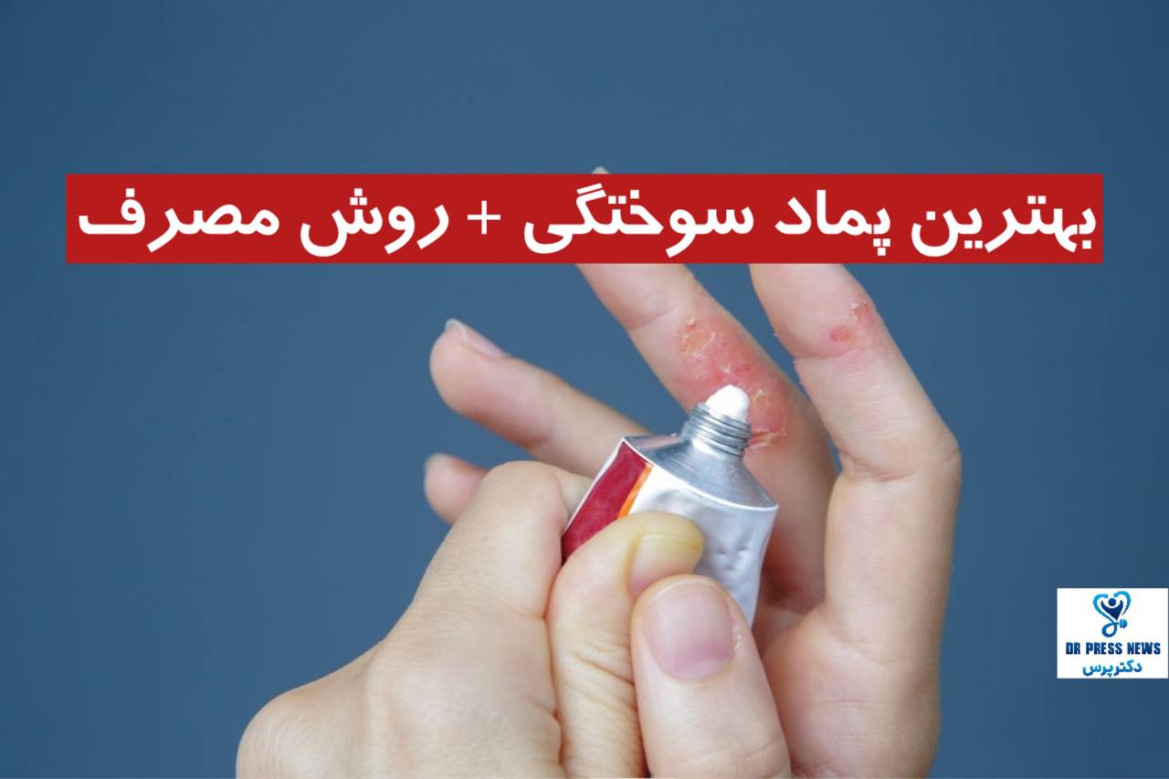 بهترین پماد سوختگی + روش مصرف + نظر کاربران و جدول