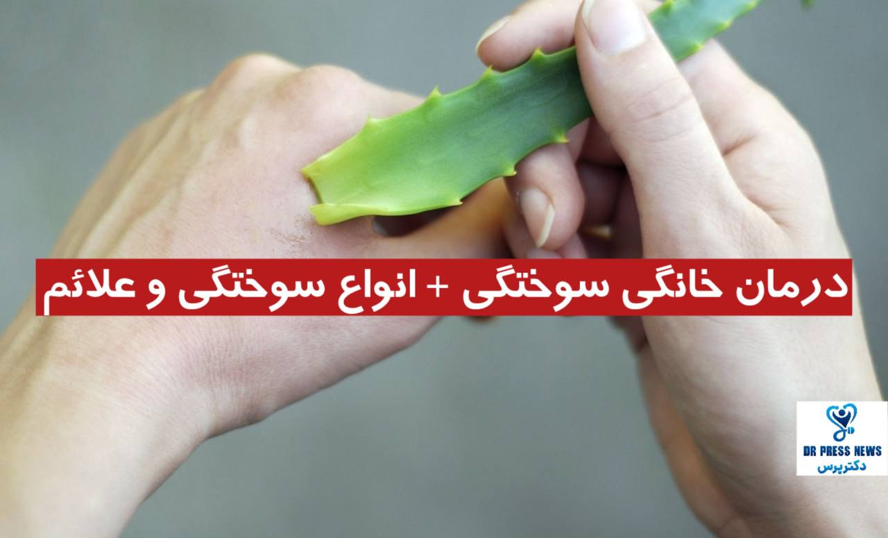 درمان خانگی سوختگی + انواع سوختگی و علائم