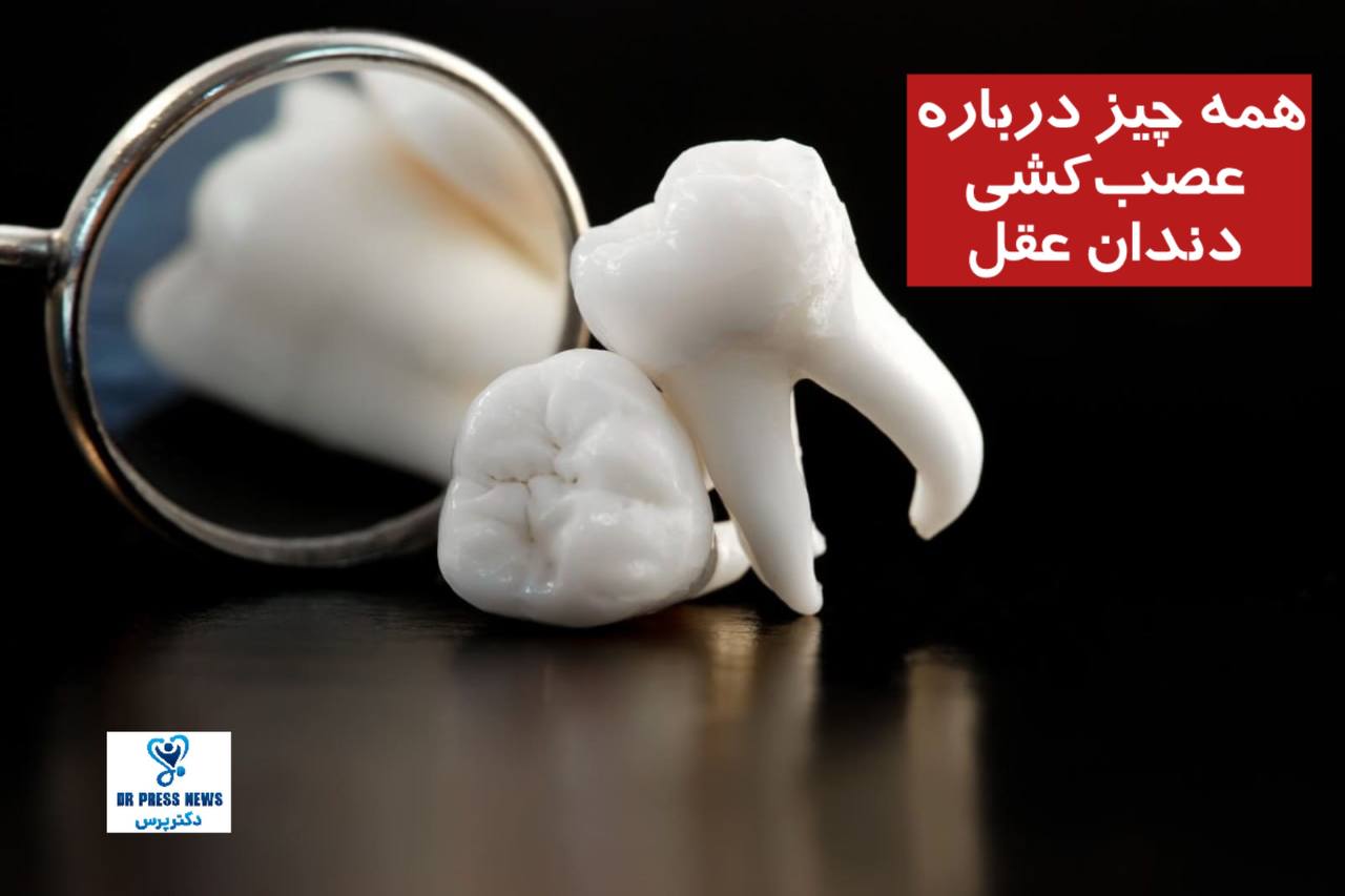 همه چیز درباره عصب‌کشی دندان عقل
