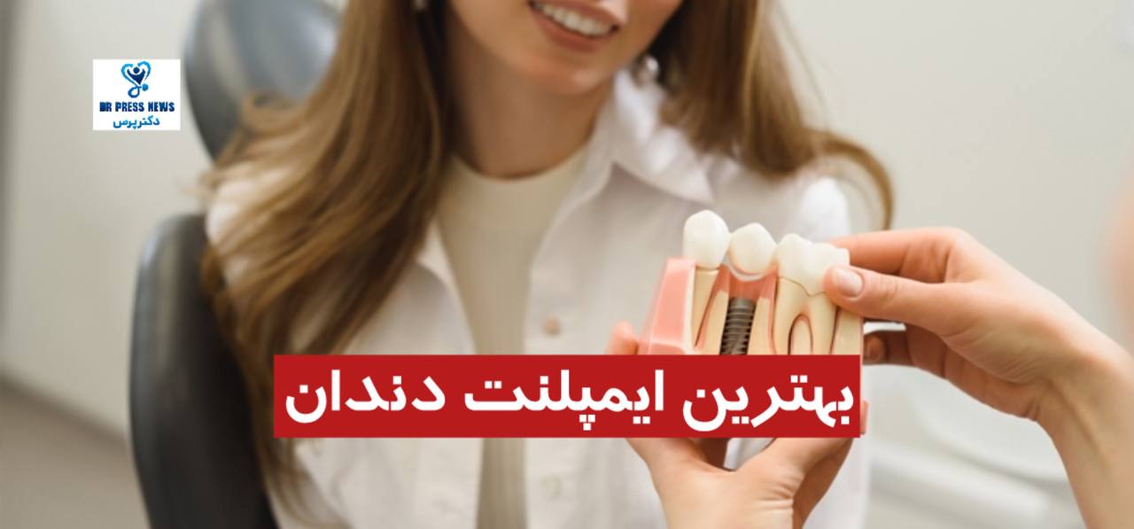 راهنمای انتخاب بهترین ایمپلنت دندان (معرفی برند و کشور سازنده)