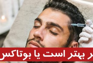 فیلر بهتر است یا بوتاکس؟ (مقایسه ماندگاری، عوارض و هزینه)