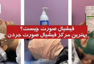 فیشیال صورت چیست؟ | بهترین مرکز فیشیال صورت جردن