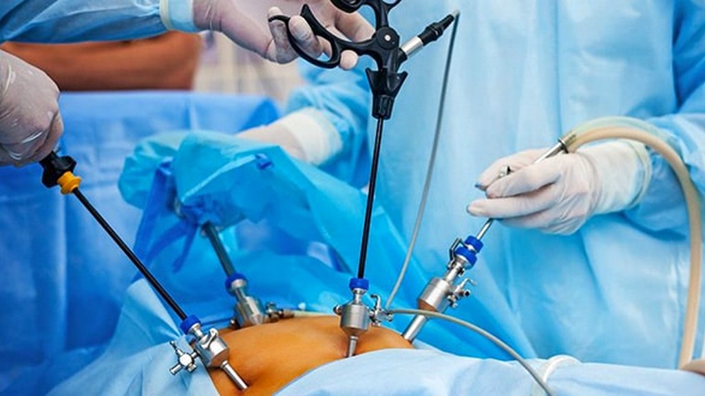 برداشتن رحم با لیزر + روش، مزایا و مراقبت‌ها