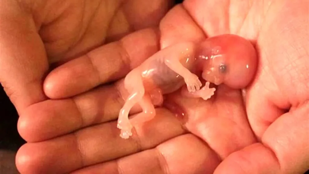 ناهنجاریهای ژنتیکی | علت، انواع و نقش آزمایشات ژنتیک در پیشگیری و تشخیص