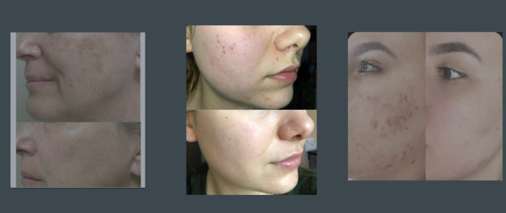 چرا کلینیک زیبایی لیلیان را انتخاب کنیم؟