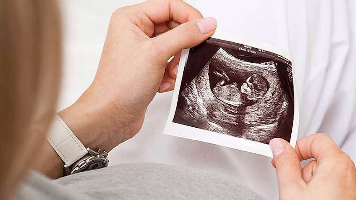 تعیین جنسیت جنین در تبریز | مطب دکتر پریسا موسی‌پور با دقت بالا