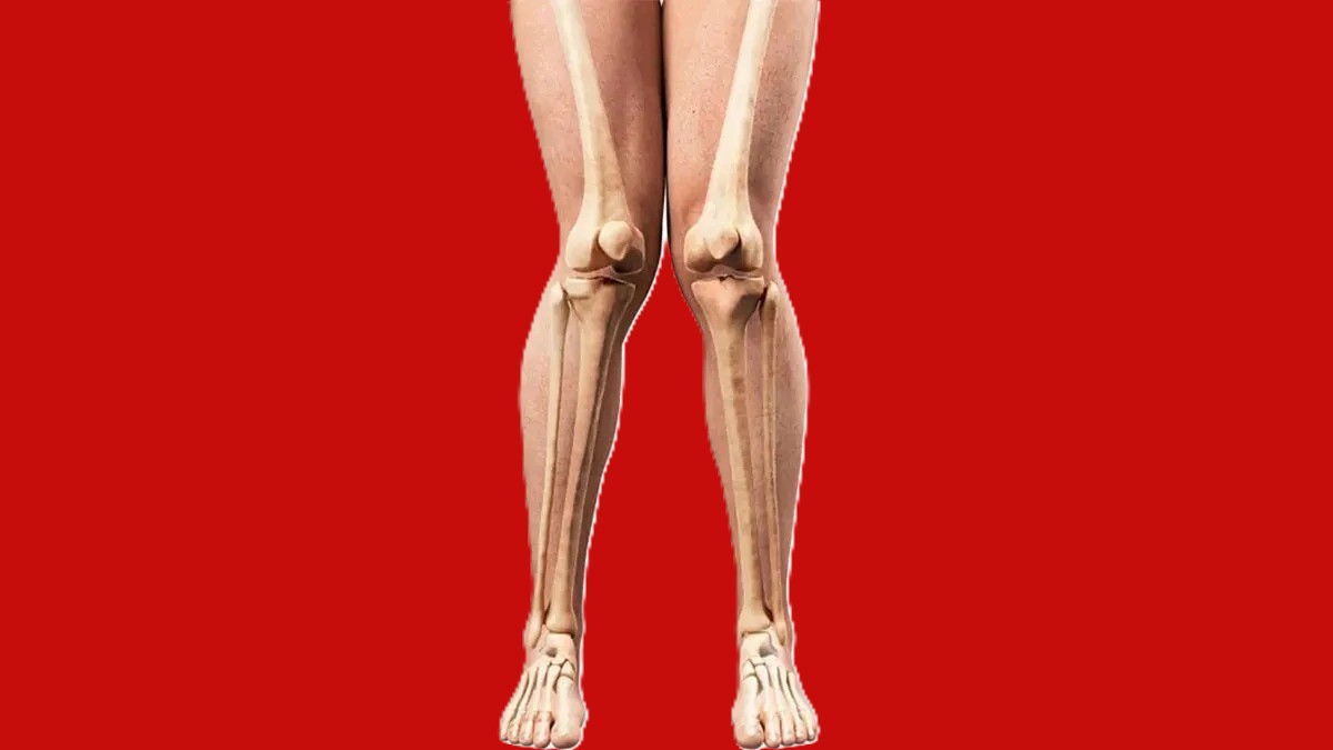 زانوی ضربدری چیست؟ علائم، علل و روش‌های درمان قطعی