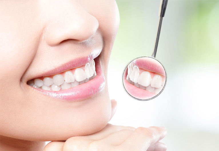 لمینت سرامیکی در تهران | راهنمای جامع برای لبخندی طبیعی و ماندگار