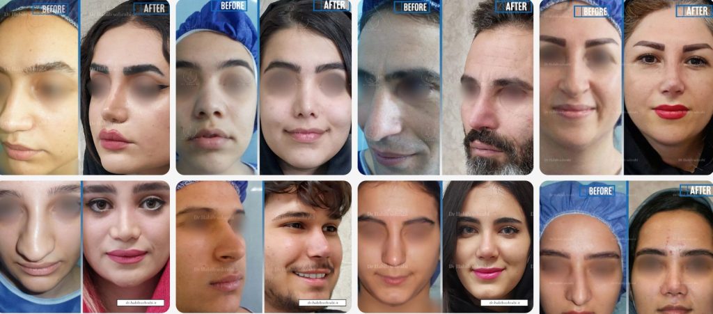 بهترین جراح بینی در تهران | راهنمای کامل انتخاب جراح بینی ایدهآل