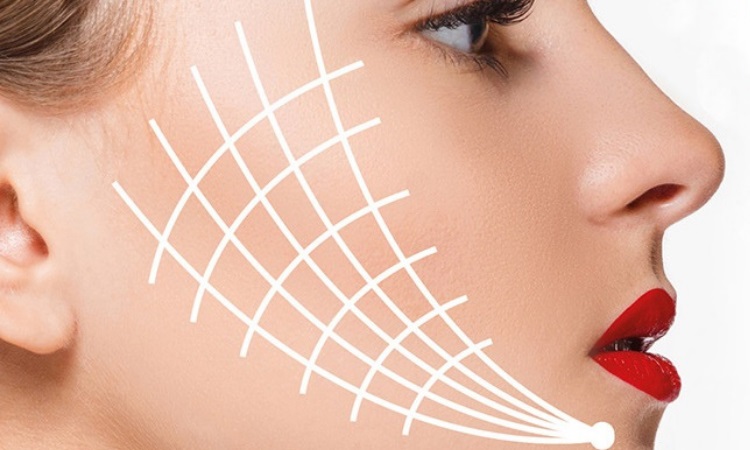 مراحل انجام لیفت صورت با نخ قدم به قدم