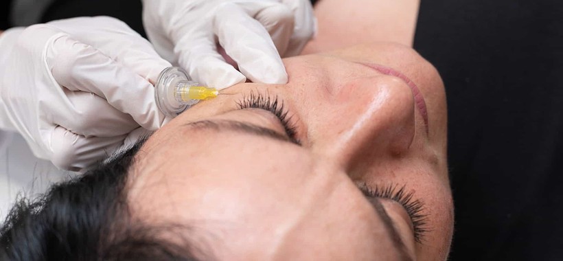 کربوکسی ‌تراپی چیست؟ | کاربردها، مزایا، عوارض + هزینه