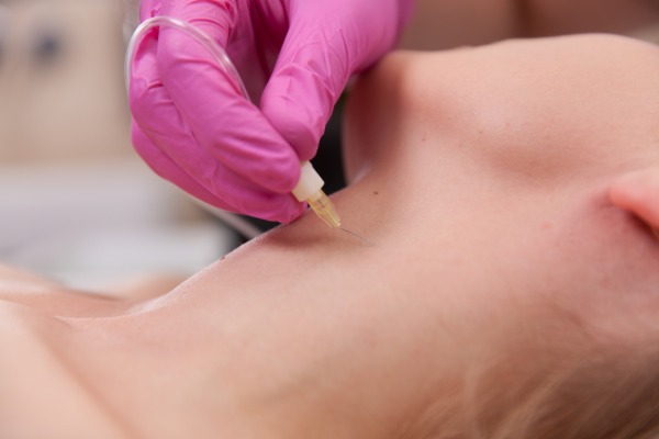 کربوکسی تراپی چیست؟ | کاربردها، مزایا، عوارض + هزینه