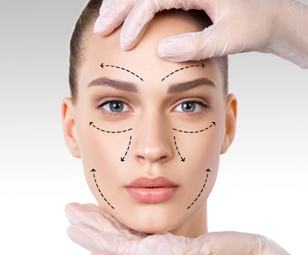 لیفت صورت با نخ | مقایسه انواع نخ‌ + هزینه‌ها