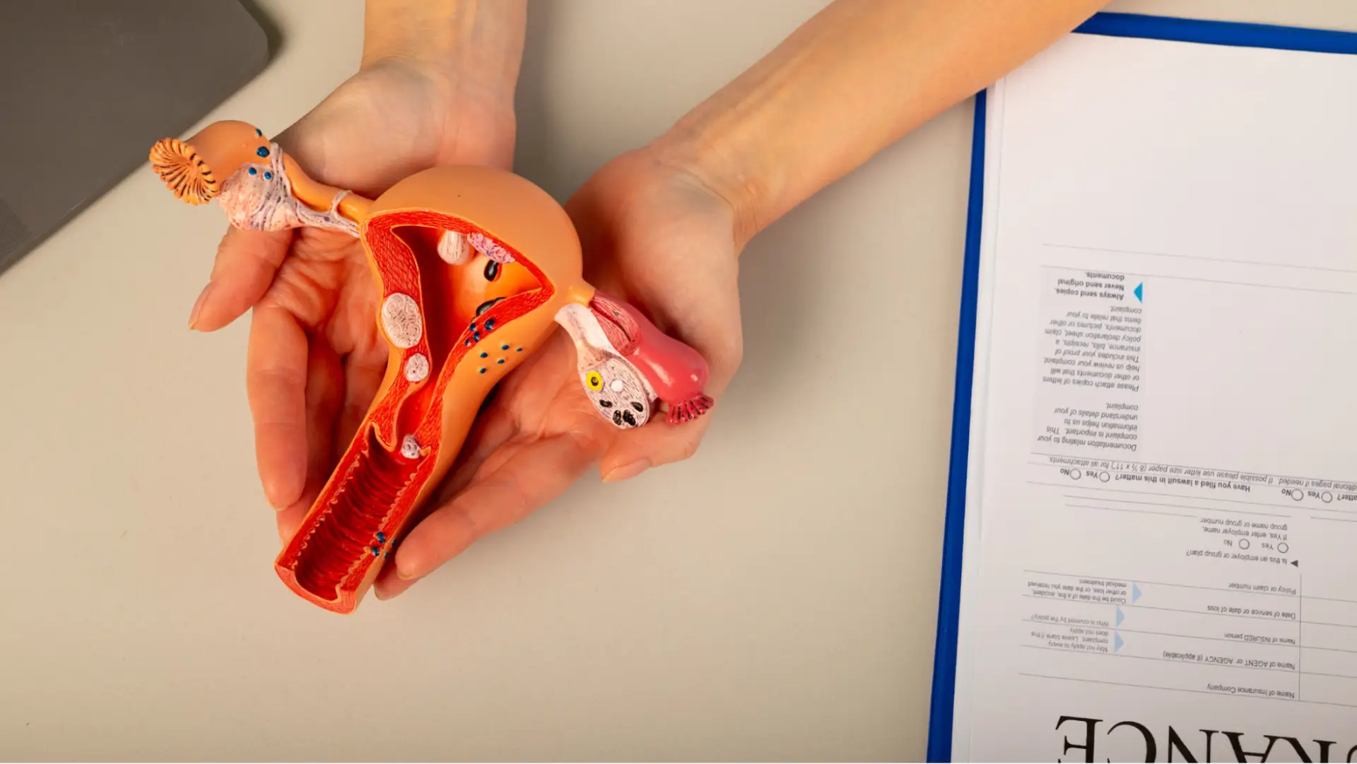 عمل هیسترکتومی (برداشتن رحم) در تهران (هر آنچه باید بدانید)