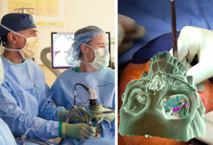 جراحی قاعده جمجمه در مشهد | بهترین روش برای درمان تومورها و ضایعات مغزی