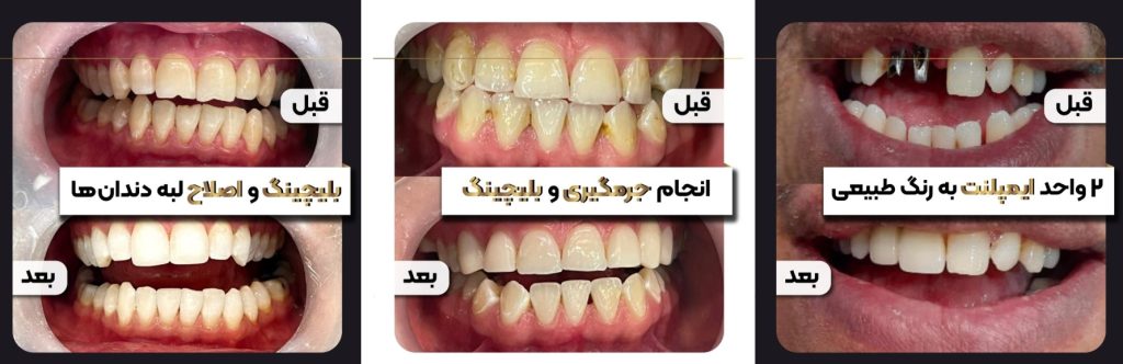 معرفی دندانپزشکی مهر (تجربه دندانپزشکی بدون درد در تهران)